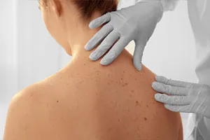 Dermatology